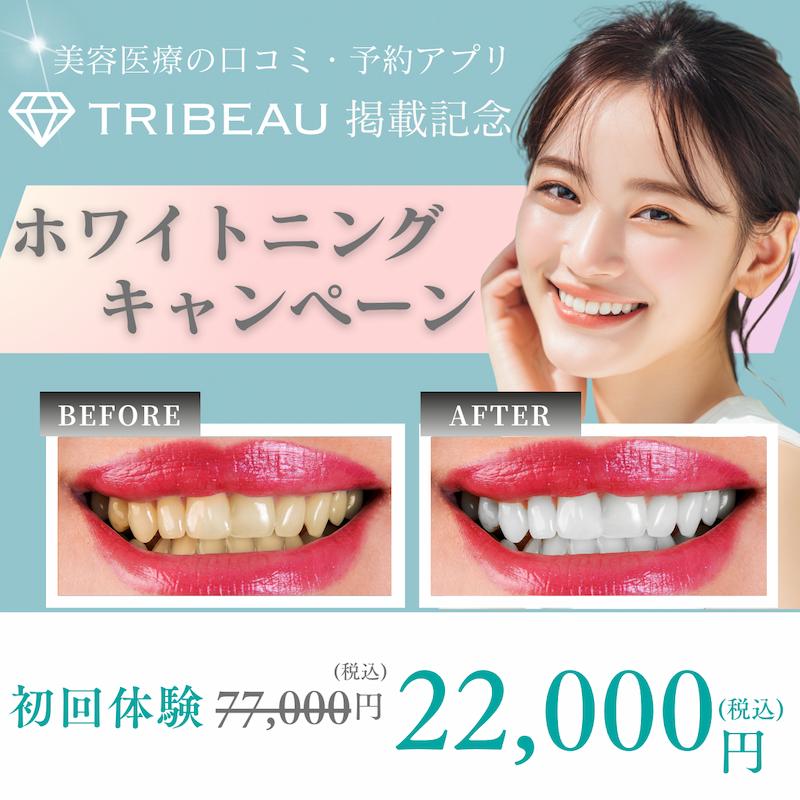 TRIBEAU ホワイトニングキャンペーン